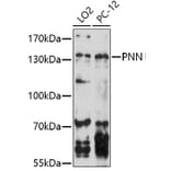 Western Blot - Anti-PNN / DRSP Antibody (A91736) - Antibodies.com