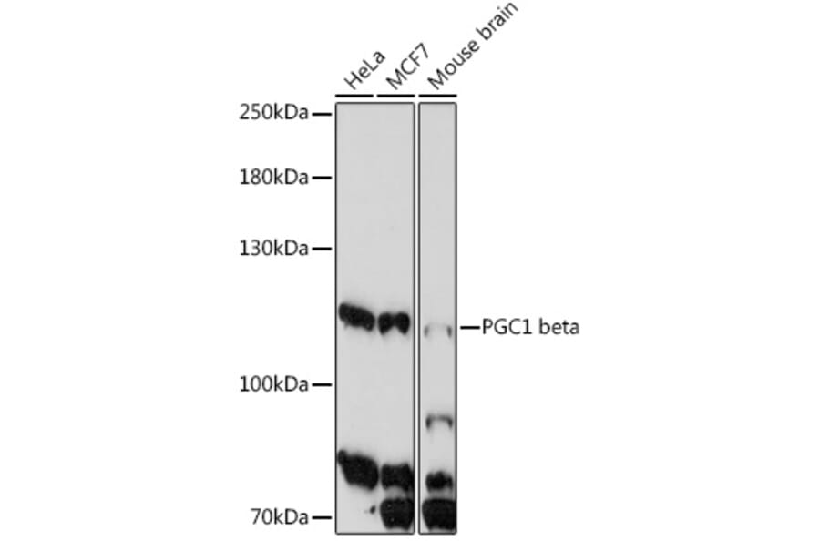 Western Blot - Anti-PGC1 beta Antibody (A91738) - Antibodies.com