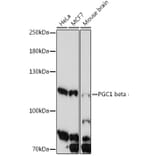Western Blot - Anti-PGC1 beta Antibody (A91738) - Antibodies.com