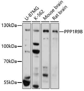 Western blot analysis of extracts of various cell lines, using Anti-PPP1R9B Antibody (A17229) at 1:1,000 dilution.
Secondary antibody: Goat Anti-Rabbit IgG (H+L) (HRP) (AS014) at 1:10,000 dilution.
Lysates / proteins: 25µg per lane.
Blocking buffer: 3% non-fat dry milk in TBST.
Detection: ECL Basic Kit (RM00020).
Exposure time: 3min.