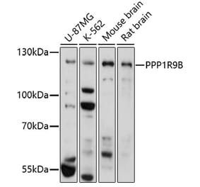 Western Blot - Anti-Spinophilin/Neurabin 2 Antibody (A91740) - Antibodies.com