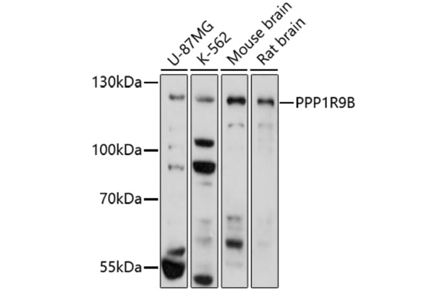 Western Blot - Anti-Spinophilin/Neurabin 2 Antibody (A91740) - Antibodies.com
