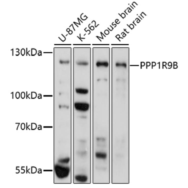 Western Blot - Anti-Spinophilin/Neurabin 2 Antibody (A91740) - Antibodies.com