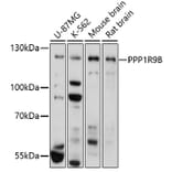 Western Blot - Anti-Spinophilin/Neurabin 2 Antibody (A91740) - Antibodies.com