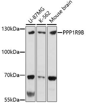 Western blot analysis of extracts of various cell lines, using Anti-PPP1R9B Antibody (A17230) at 1:1,000 dilution.
Secondary antibody: Goat Anti-Rabbit IgG (H+L) (HRP) (AS014) at 1:10,000 dilution.
Lysates / proteins: 25µg per lane.
Blocking buffer: 3% non-fat dry milk in TBST.
Detection: ECL Basic Kit (RM00020).
Exposure time: 3min.