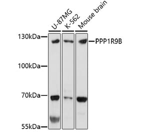 Western Blot - Anti-Spinophilin/Neurabin 2 Antibody (A91741) - Antibodies.com
