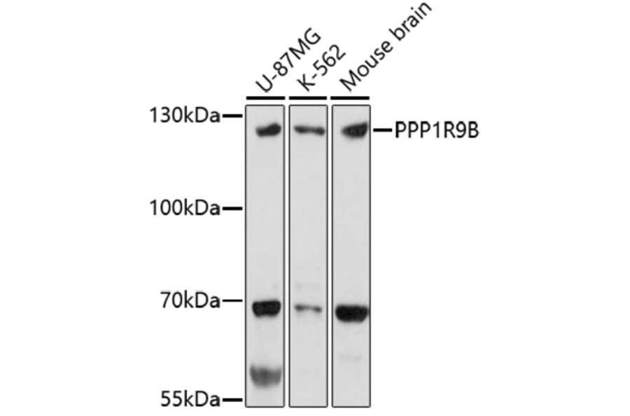 Western Blot - Anti-Spinophilin/Neurabin 2 Antibody (A91741) - Antibodies.com