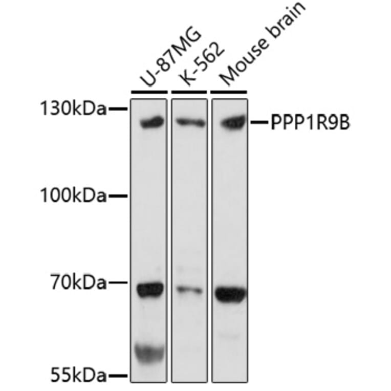 Western Blot - Anti-Spinophilin/Neurabin 2 Antibody (A91741) - Antibodies.com