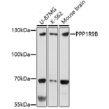 Western Blot - Anti-Spinophilin/Neurabin 2 Antibody (A91741) - Antibodies.com