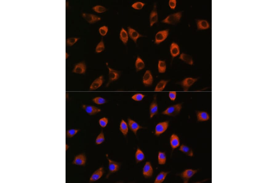 Immunofluorescence - Anti-Spinophilin/Neurabin 2 Antibody (A91741) - Antibodies.com