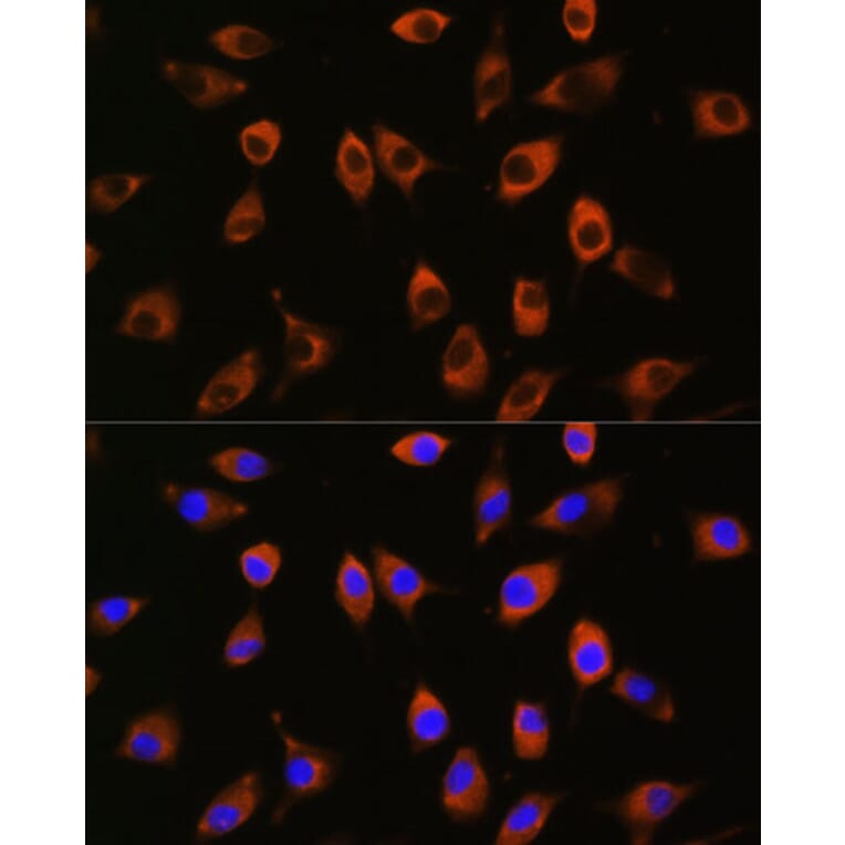Immunofluorescence - Anti-Spinophilin/Neurabin 2 Antibody (A91741) - Antibodies.com