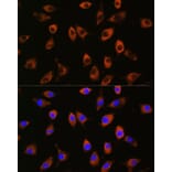 Immunofluorescence - Anti-Spinophilin/Neurabin 2 Antibody (A91741) - Antibodies.com