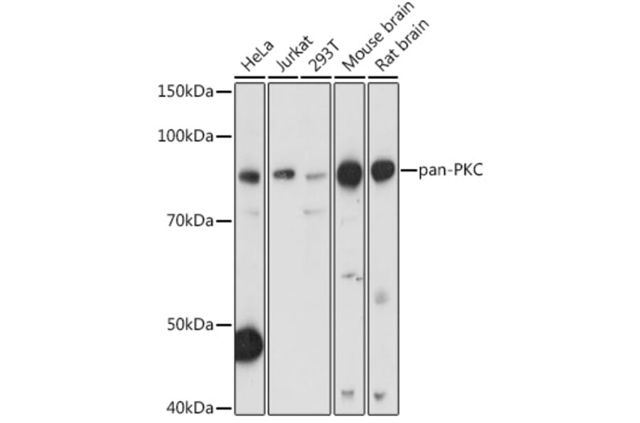Western Blot - Anti-pan PKC Antibody (A91745) - Antibodies.com