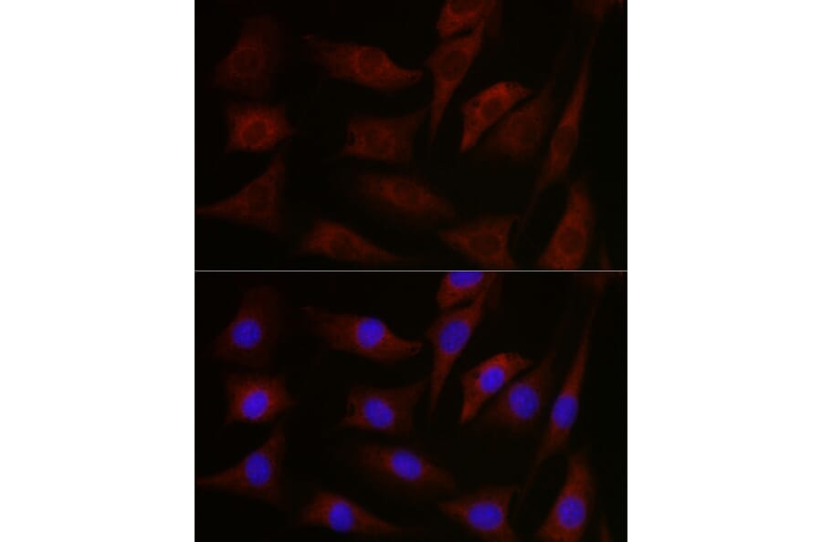Immunofluorescence - Anti-pan PKC Antibody (A91745) - Antibodies.com