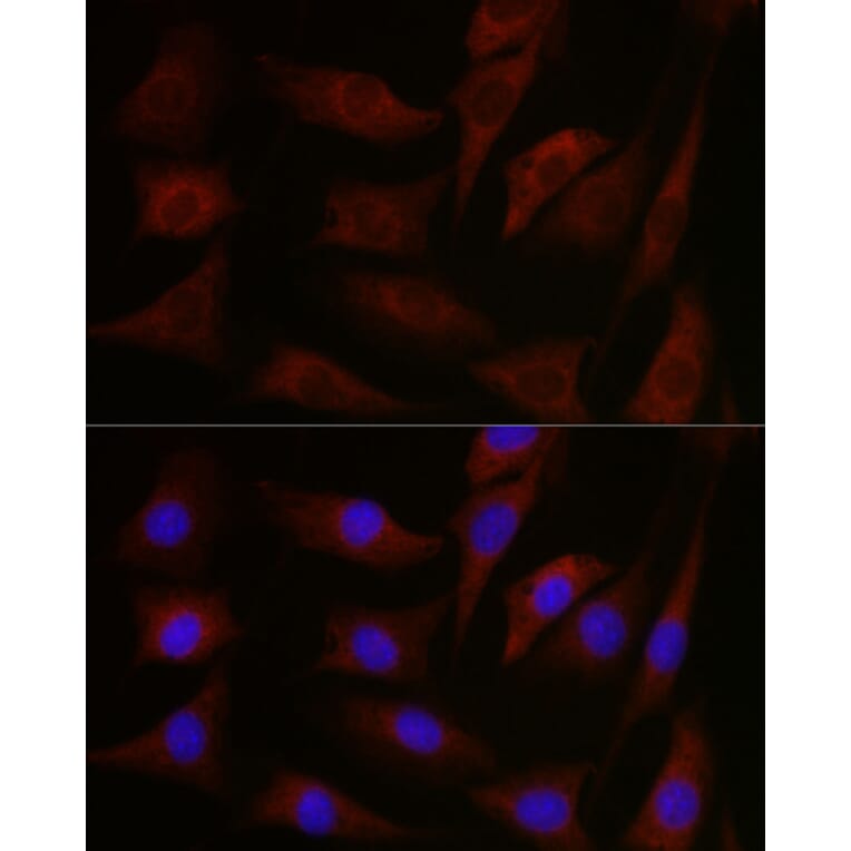 Immunofluorescence - Anti-pan PKC Antibody (A91745) - Antibodies.com