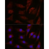 Immunofluorescence - Anti-pan PKC Antibody (A91745) - Antibodies.com