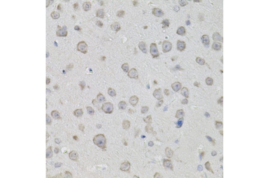 Immunohistochemistry - Anti-PROM1 Antibody (A0510) - Antibodies.com