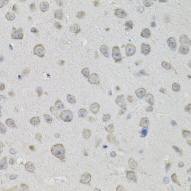 Immunohistochemistry - Anti-PROM1 Antibody (A0510) - Antibodies.com
