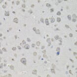 Immunohistochemistry - Anti-PROM1 Antibody (A0510) - Antibodies.com