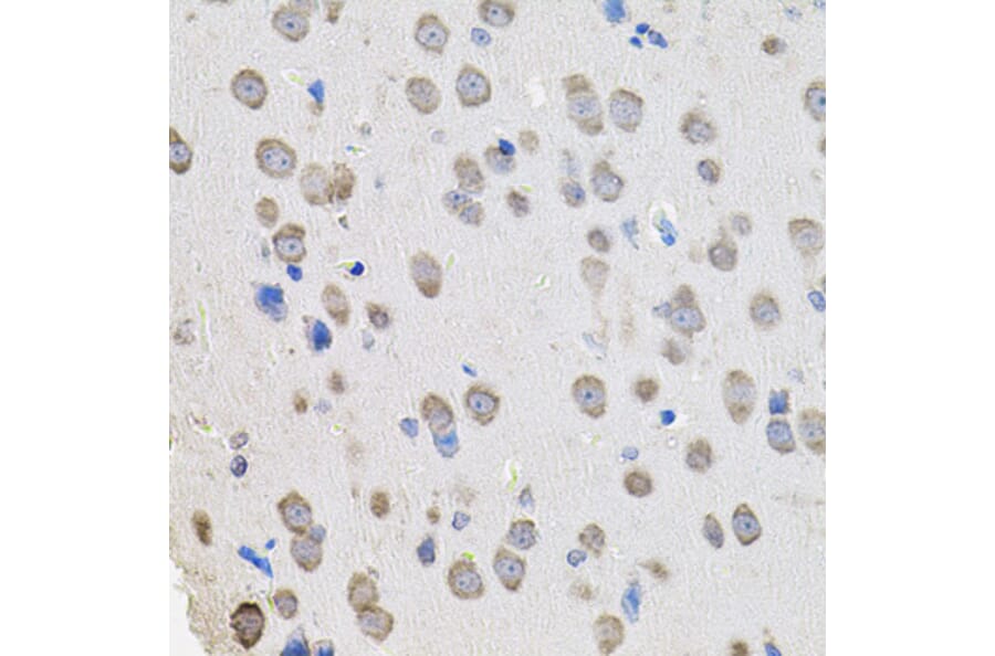 Immunohistochemistry - Anti-PROM1 Antibody (A0510) - Antibodies.com