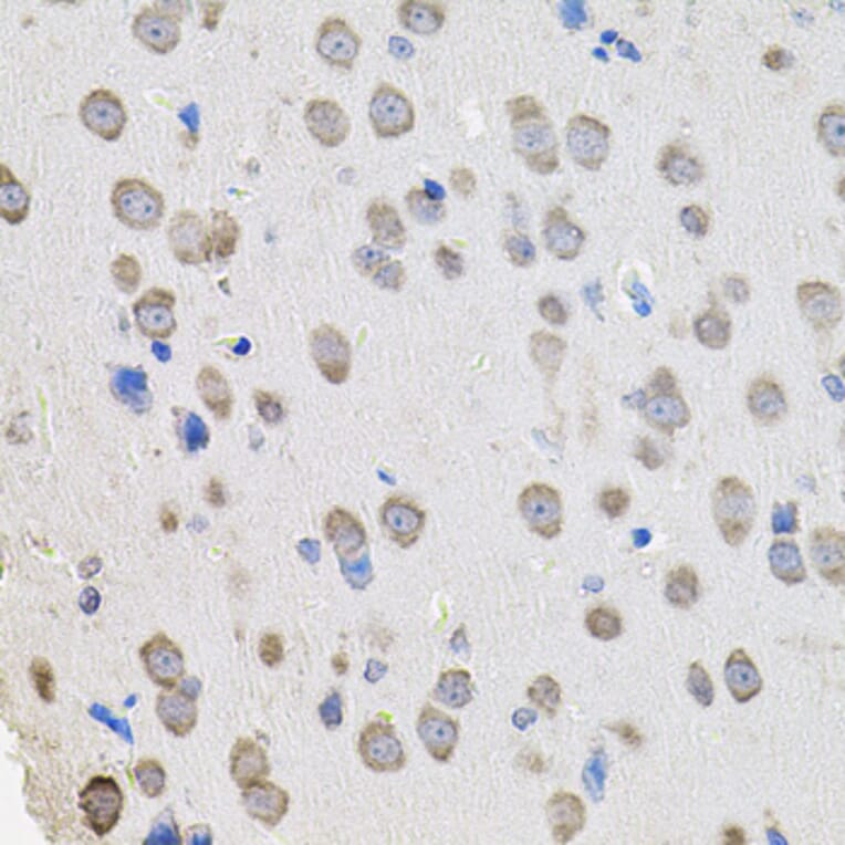 Immunohistochemistry - Anti-PROM1 Antibody (A0510) - Antibodies.com
