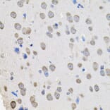 Immunohistochemistry - Anti-PROM1 Antibody (A0510) - Antibodies.com
