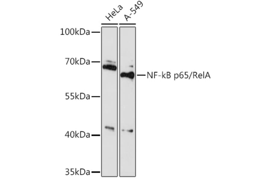 Western Blot - Anti-NF-kB p65 Antibody (A91748) - Antibodies.com