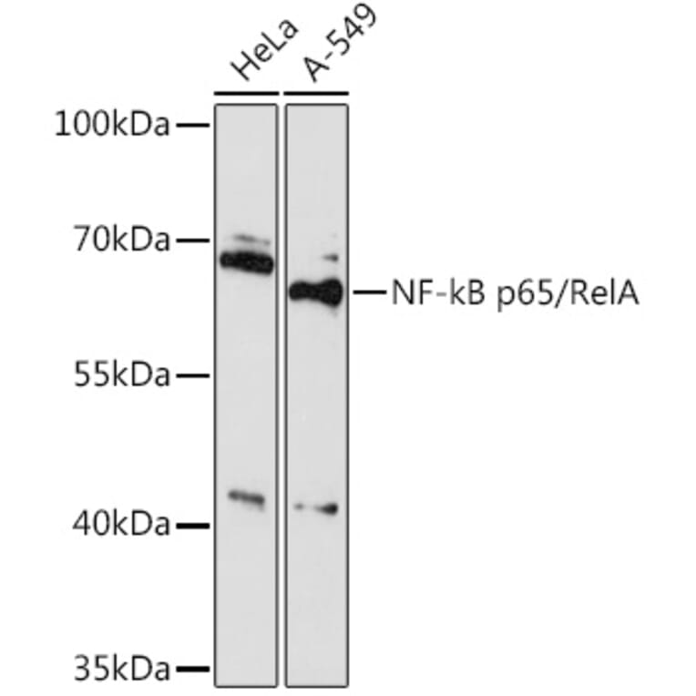 Western Blot - Anti-NF-kB p65 Antibody (A91748) - Antibodies.com