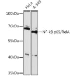 Western Blot - Anti-NF-kB p65 Antibody (A91748) - Antibodies.com
