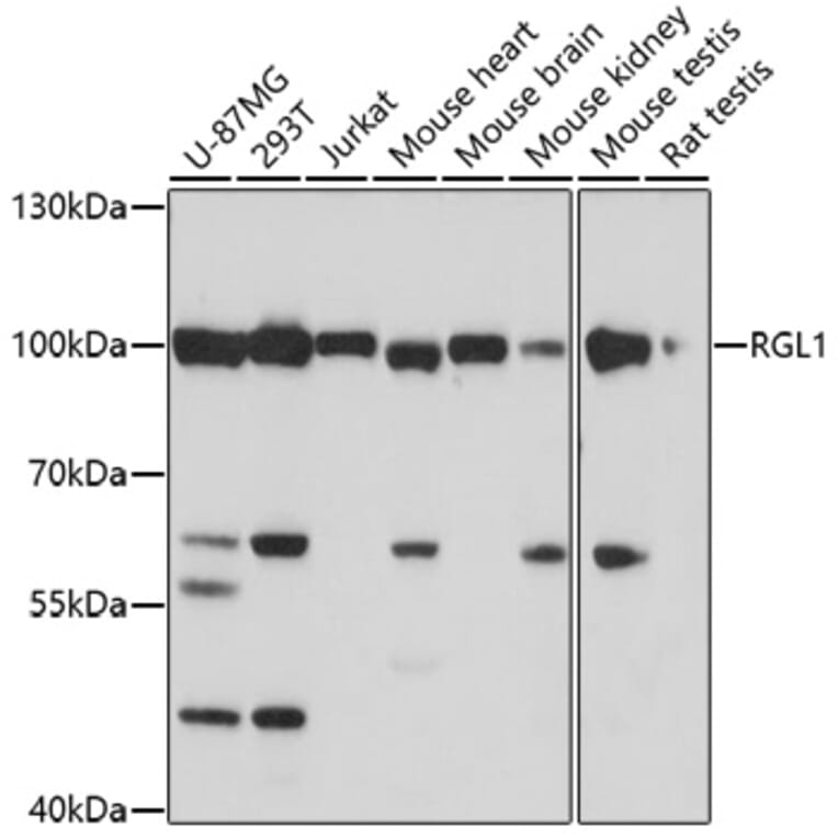 Western Blot - Anti-RGL1 Antibody (A91749) - Antibodies.com