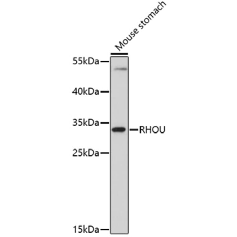 Western Blot - Anti-RHOU Antibody (A91752) - Antibodies.com