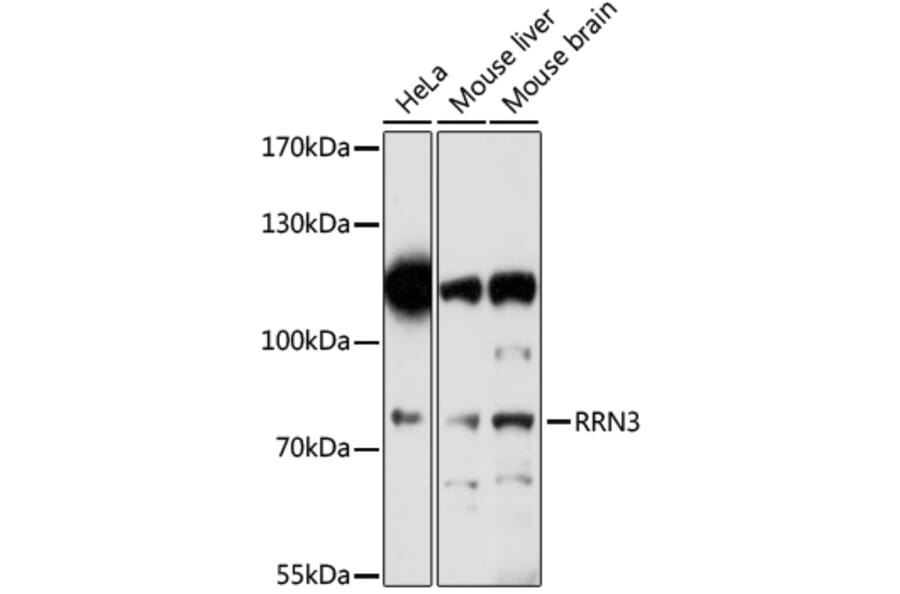 Western Blot - Anti-RRN3 Antibody (A91754) - Antibodies.com