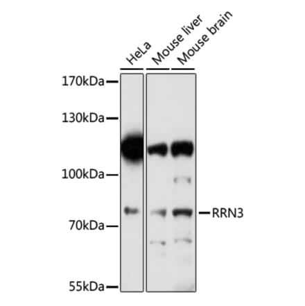 Western Blot - Anti-RRN3 Antibody (A91754) - Antibodies.com