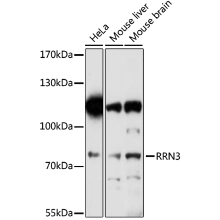 Western Blot - Anti-RRN3 Antibody (A91754) - Antibodies.com