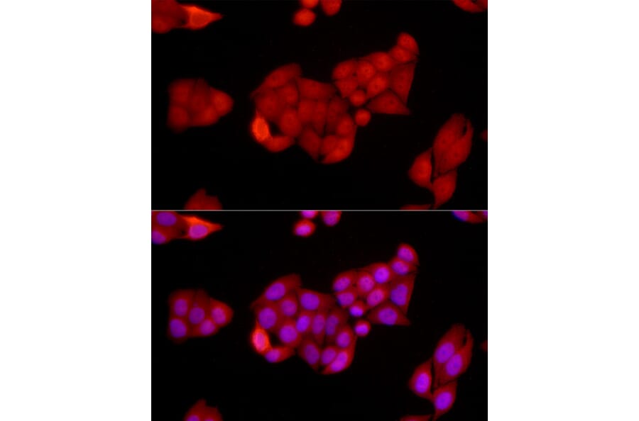 Immunofluorescence - Anti-SIRT1 Antibody (A91756) - Antibodies.com