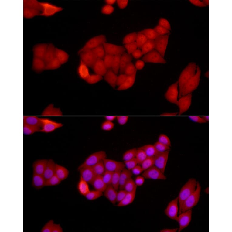 Immunofluorescence - Anti-SIRT1 Antibody (A91756) - Antibodies.com