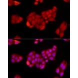 Immunofluorescence - Anti-SIRT1 Antibody (A91756) - Antibodies.com