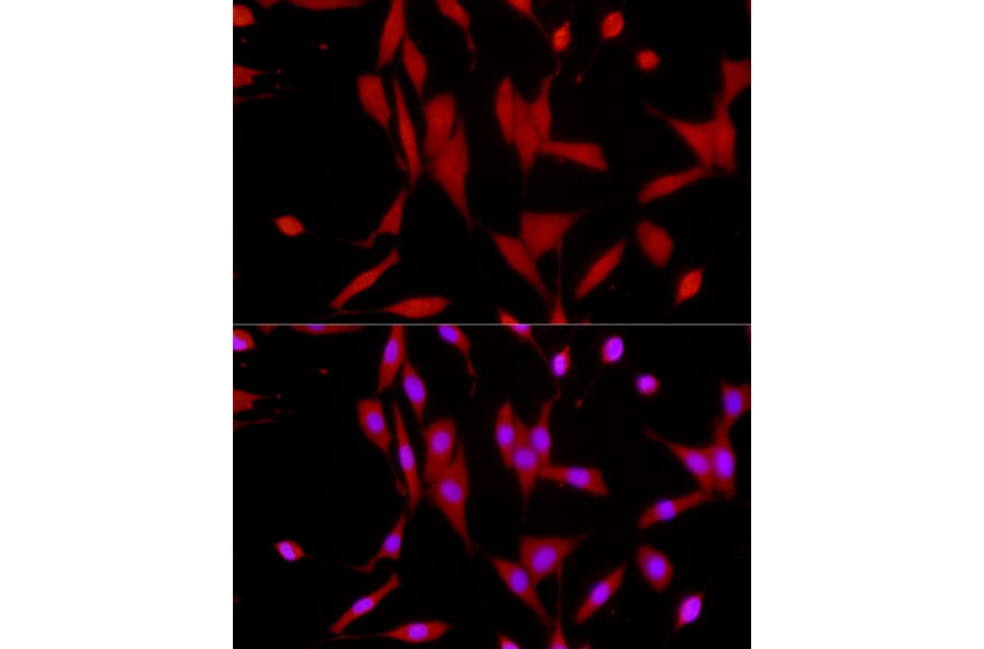 Immunofluorescence - Anti-SIRT1 Antibody (A91756) - Antibodies.com
