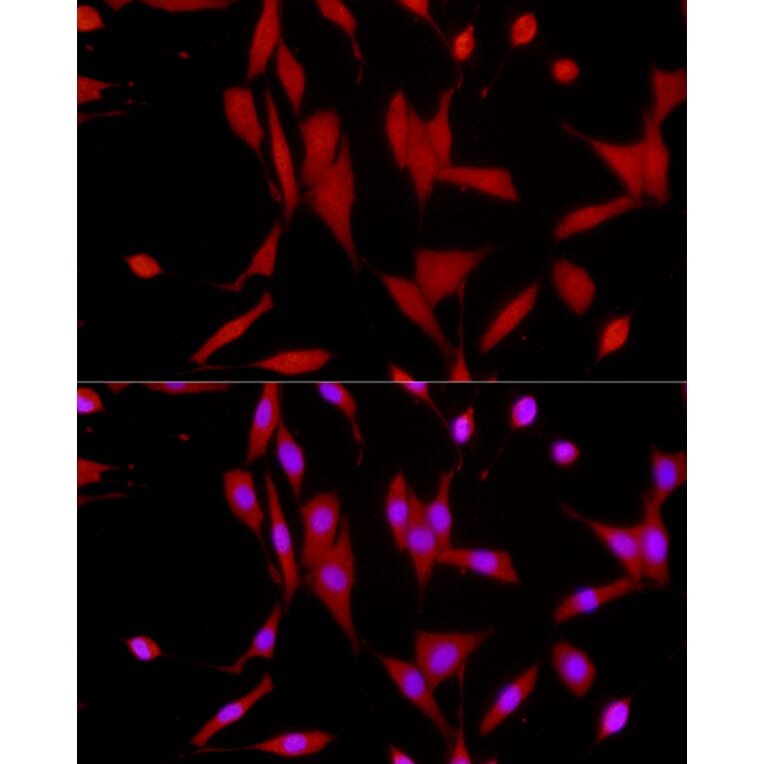 Immunofluorescence - Anti-SIRT1 Antibody (A91756) - Antibodies.com