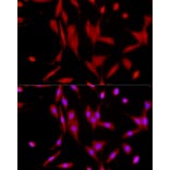 Immunofluorescence - Anti-SIRT1 Antibody (A91756) - Antibodies.com