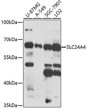 Western blot analysis of extracts of various cell lines, using Anti-SLC24A4 Antibody (A17254) at 1:1,000 dilution.
Secondary antibody: Goat Anti-Rabbit IgG (H+L) (HRP) (AS014) at 1:10,000 dilution.
Lysates / proteins: 25µg per lane.
Blocking buffer: 3% non-fat dry milk in TBST.
Detection: ECL Enhanced Kit (RM00021).
Exposure time: 90s.