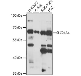 Western Blot - Anti-SLC24A4 Antibody (A91757) - Antibodies.com