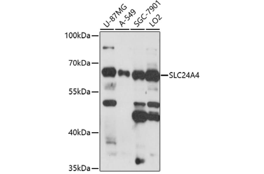 Western Blot - Anti-SLC24A4 Antibody (A91757) - Antibodies.com