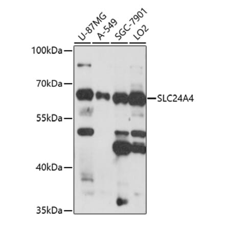 Western Blot - Anti-SLC24A4 Antibody (A91757) - Antibodies.com