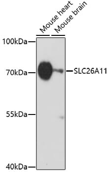 Western blot analysis of extracts of various cell lines, using Anti-SLC26A11 Antibody (A17276) at 1:1,000 dilution.
Secondary antibody: Goat Anti-Rabbit IgG (H+L) (HRP) (AS014) at 1:10,000 dilution.
Lysates / proteins: 25µg per lane.
Blocking buffer: 3% non-fat dry milk in TBST.
Detection: ECL Basic Kit (RM00020).
Exposure time: 60s.