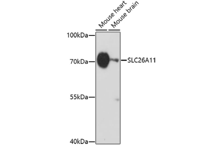 Western Blot - Anti-SLC26A11 Antibody (A91758) - Antibodies.com