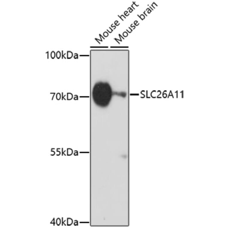 Western Blot - Anti-SLC26A11 Antibody (A91758) - Antibodies.com