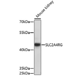 Western Blot - Anti-SLC2A4RG Antibody (A91759) - Antibodies.com