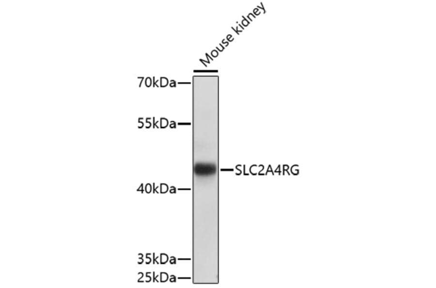 Western Blot - Anti-SLC2A4RG Antibody (A91759) - Antibodies.com