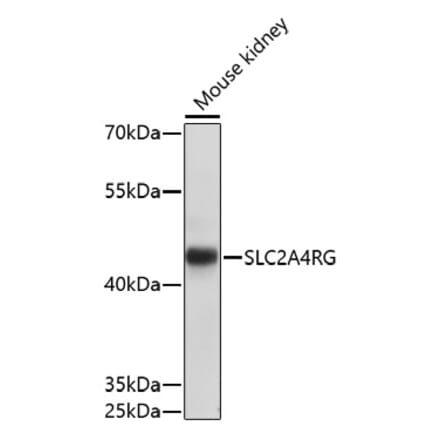 Western Blot - Anti-SLC2A4RG Antibody (A91759) - Antibodies.com